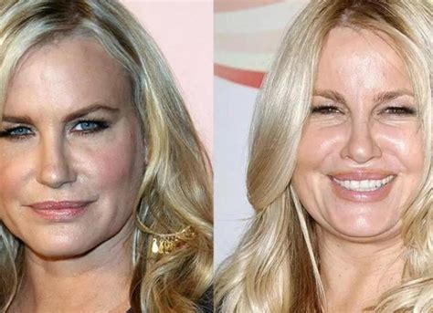 jennifer coolidge before surgery|Jennifer Coolidge Before Plastic Surgery: The。